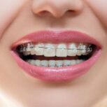 دکتر پرشنگ شهسواری متخصص  اورتودنسی