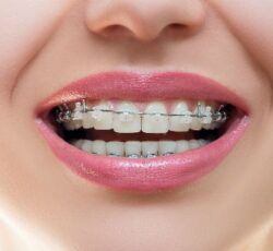 دکتر پرشنگ شهسواری متخصص  اورتودنسی