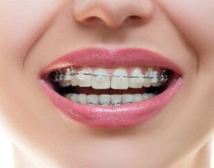 دکتر پرشنگ شهسواری متخصص  اورتودنسی