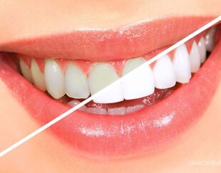 دندانپزشکی زیتون