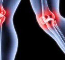 دکتر هومن جولائی جراح و متخصص ارتوپدی