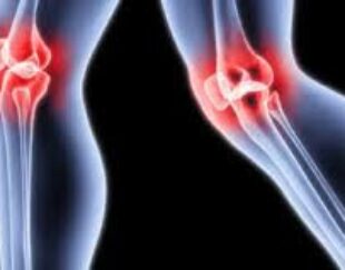 دکتر هومن جولائی جراح و متخصص ارتوپدی