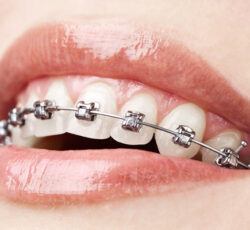 دکتر عباس نوری نژاد دندانپزشک