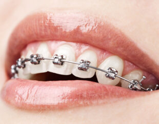 دکتر عباس نوری نژاد دندانپزشک