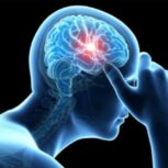 دکتر حیدرزاده  متخصص مغز و اعصاب