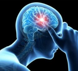 دکتر حیدرزاده  متخصص مغز و اعصاب