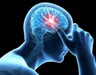 دکتر حیدرزاده  متخصص مغز و اعصاب