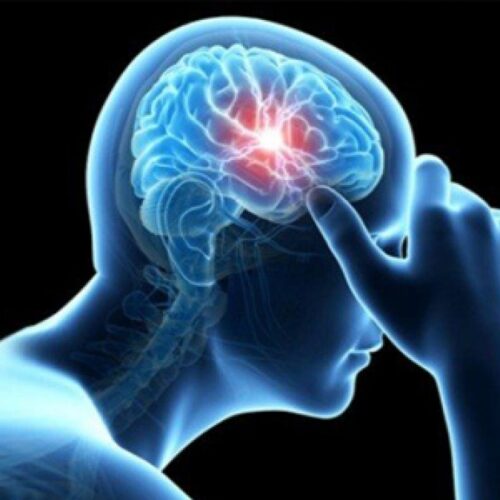 دکتر حیدرزاده  متخصص مغز و اعصاب