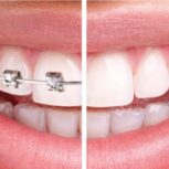 دکتر علی محمدی دندانپزشک