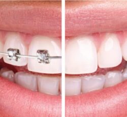 دکتر علی محمدی دندانپزشک