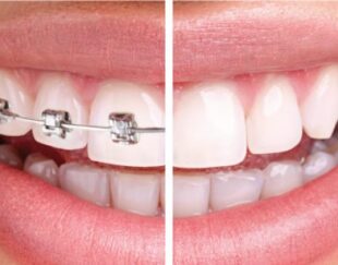 دکتر علی محمدی دندانپزشک