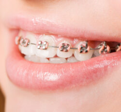 دکتر مجتبی هرندی دندانپزشک