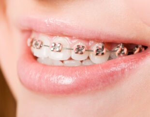 دکتر مجتبی هرندی دندانپزشک