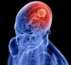 دکتر مرتضی فتحی  متخصص مغز و اعصاب