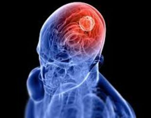 دکتر مرتضی فتحی  متخصص مغز و اعصاب