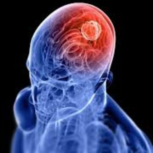 دکتر مرتضی فتحی  متخصص مغز و اعصاب