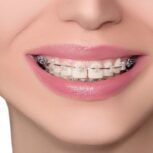 دکتر فرسید موسوی دندانپزشک