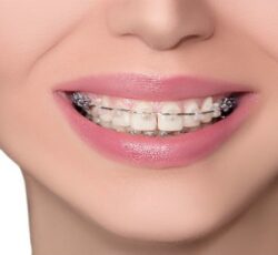 دکتر فرسید موسوی دندانپزشک